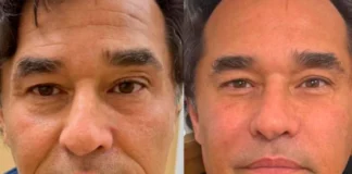 Luciano Szafir faz harmonização facial e gera revolta nas redes: ‘Era tão bonito’