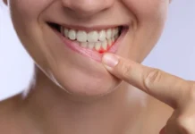 Você ignora esse sinal ao escovar os dentes? Médicos alertam para risco que vai além da boca