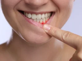 Você ignora esse sinal ao escovar os dentes? Médicos alertam para risco que vai além da boca