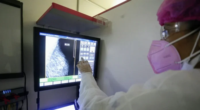 Critérios podem deixar até 95% das mulheres jovens com câncer de mama fora do radar